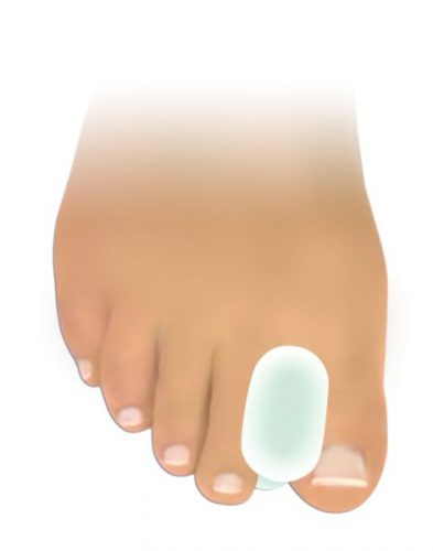 Geliniai tarpupirščių plėtikliai (Fresco F-00054)